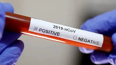 Representative image