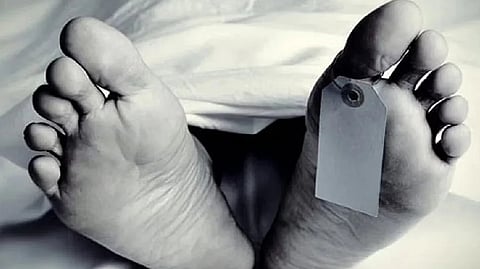 Representative image