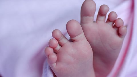 Representative image