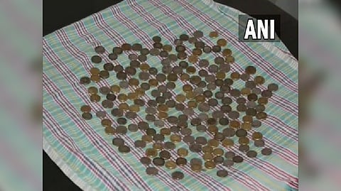 The coins recovered by doctors from the patient's stomach