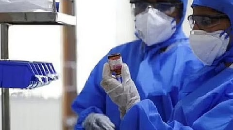 Representative image