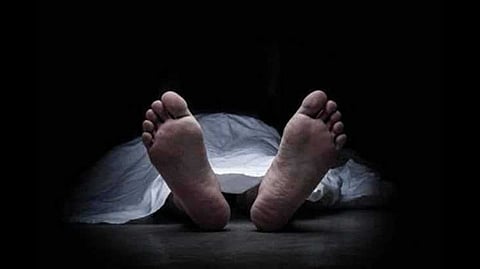 Representative image