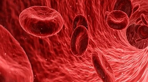 Representative image