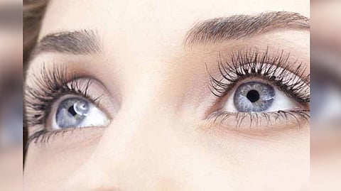 Representative image