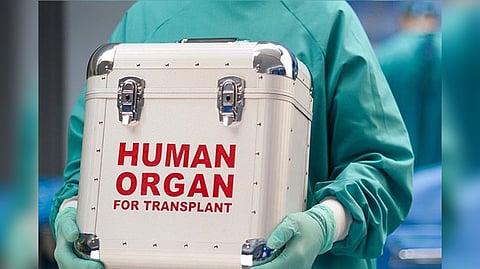 Representative image