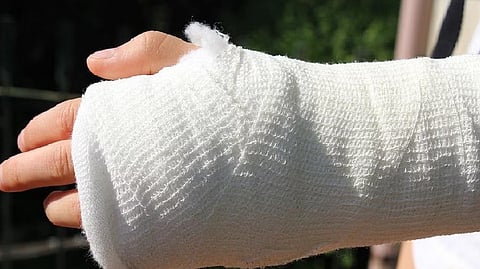 Representative image