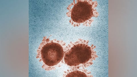 Representative image