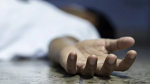 Representative image