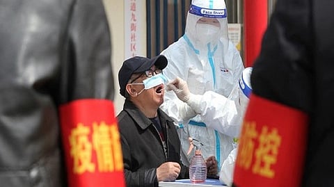 Representative image