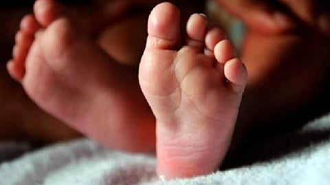 Representative image