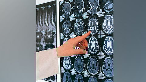 Representative image