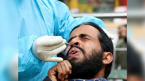 Representative image