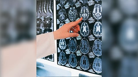 Representative Image