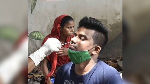 Representative image