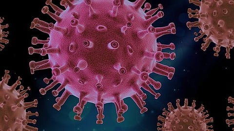 Representative image