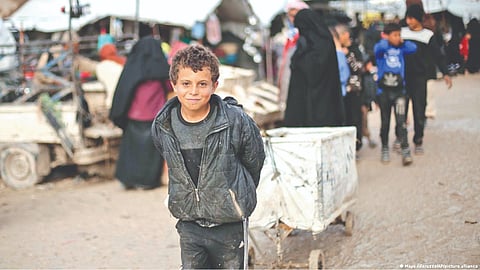 Representative Image