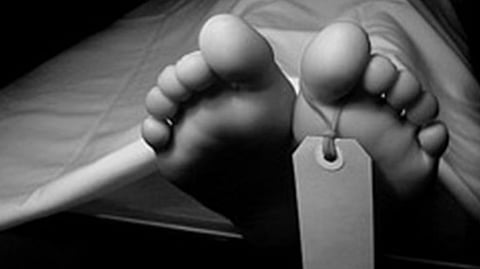 Representative image