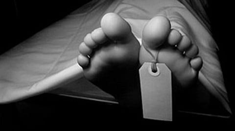 Representative image