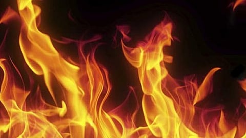 Representative image