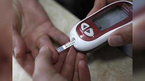 Representative Image