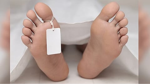 Representative image