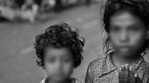 Representative image