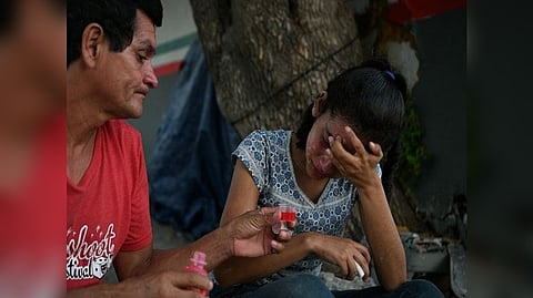 Representative image