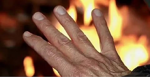 Representative Image