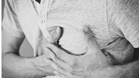 Representative Image