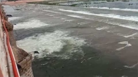 Representative image