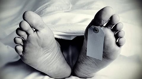 Representative image