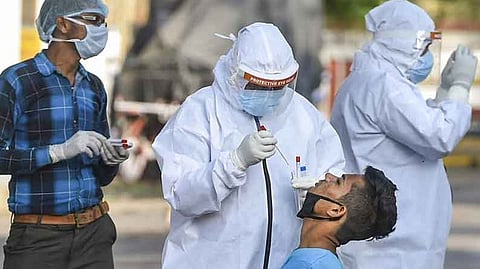 Representative image