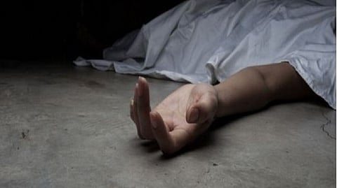 Representative image