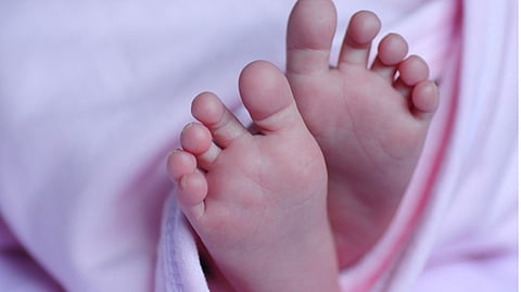 Representative image