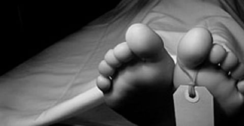 Representative Image