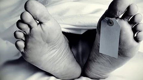 Representative image