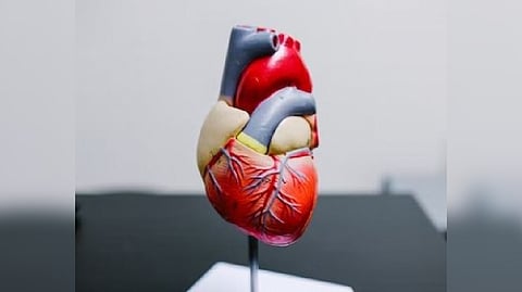 Representative image