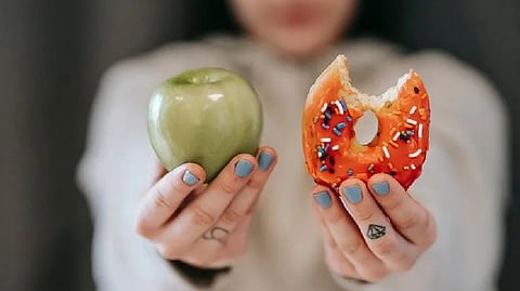 Representative image