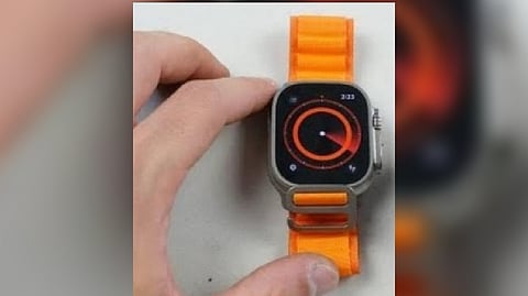 Representative image