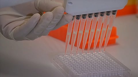 Representative image