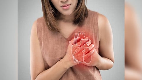 Representative image