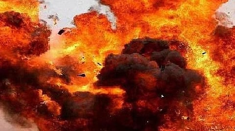 Representative image