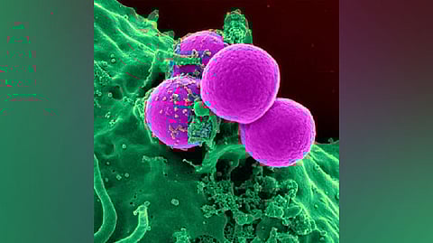 Representative image