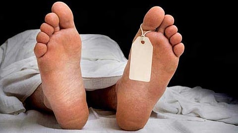 Representative Image