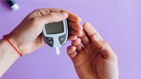 Representative Image