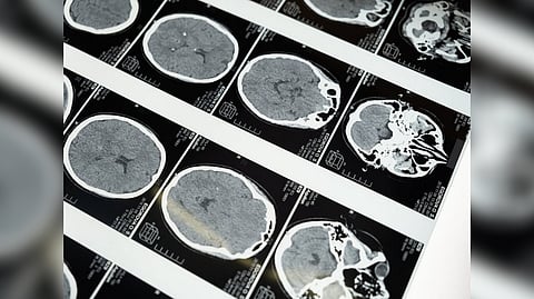 Representative image