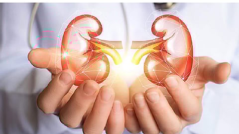 Representative image