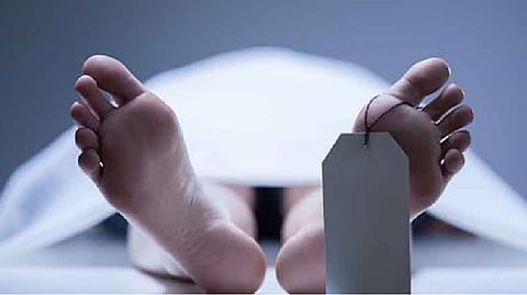 Representative image