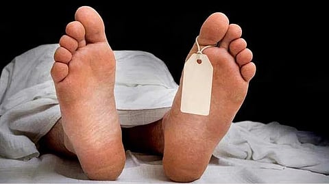 Representative image