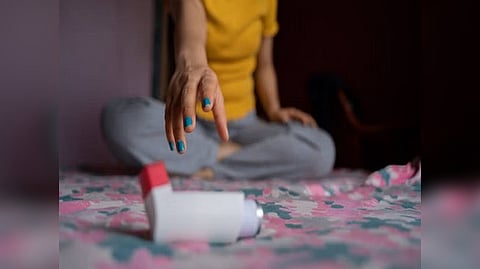 Representative image